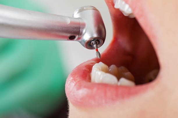 Best After-Hours Emergency Dentist in Algonquin, MD